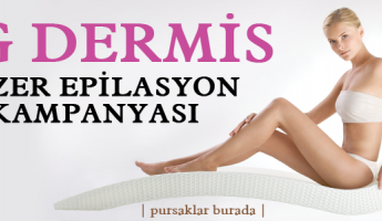 Lazer Epilasyonda Kampanya